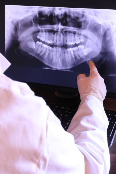 Best Emergency Wisdom Tooth Extraction in Hillview, KY