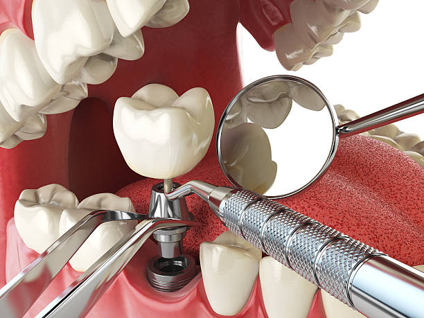 Trusted KY Emergency Dental Service Experts