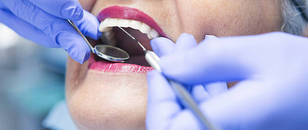 Best Knocked-Out Tooth (Avulsed Tooth) Treatment in Hillview, KY